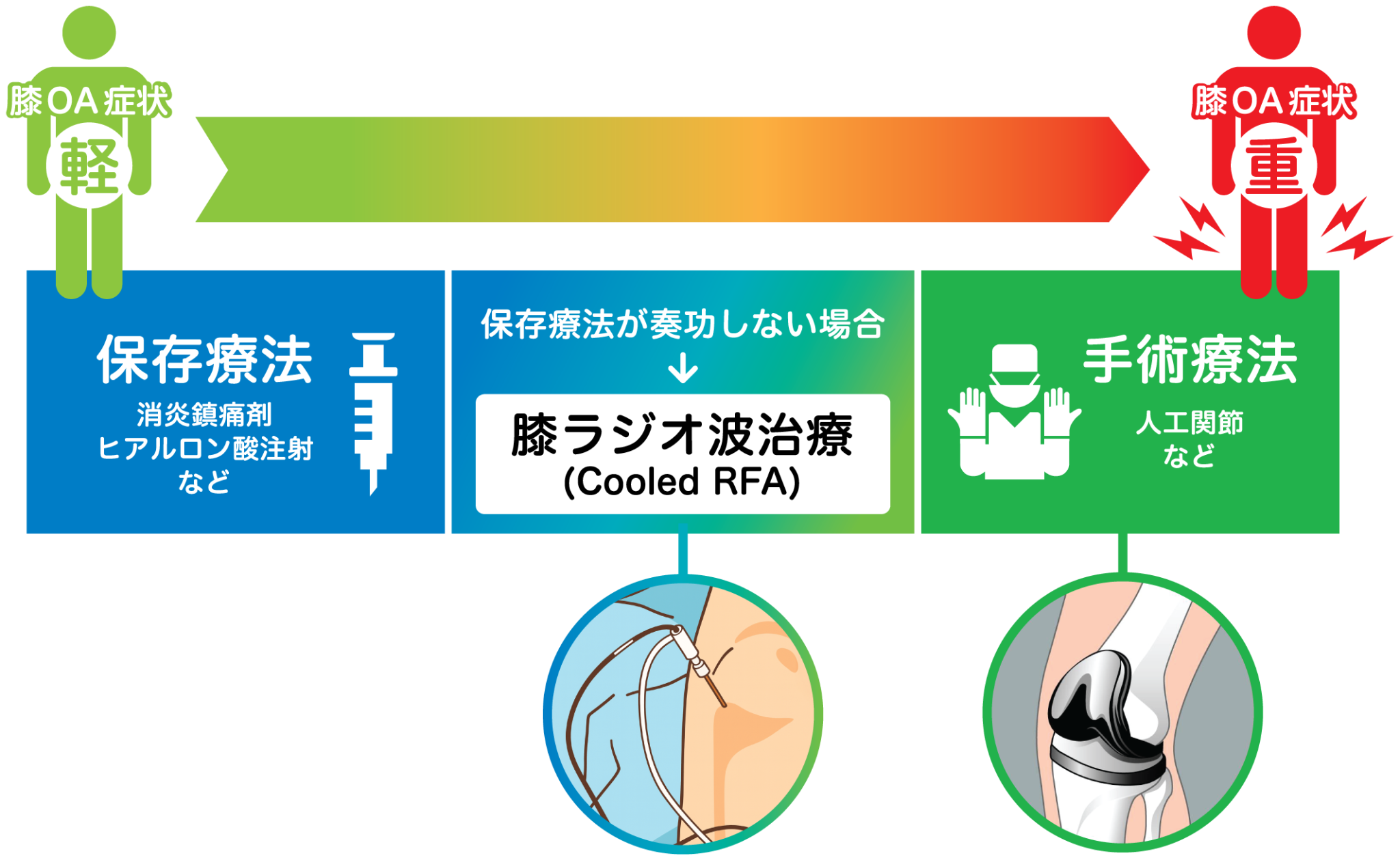 保存療法と手術療法の間に位置する膝ラジオ波治療のイメージ